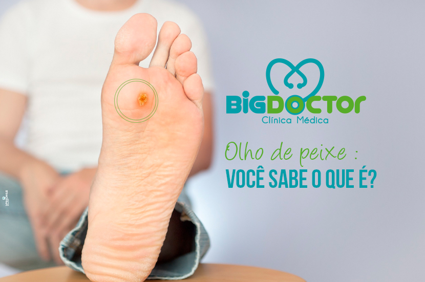 Olho De Peixe Voc Sabe O Que Cl Nica Big Doctor