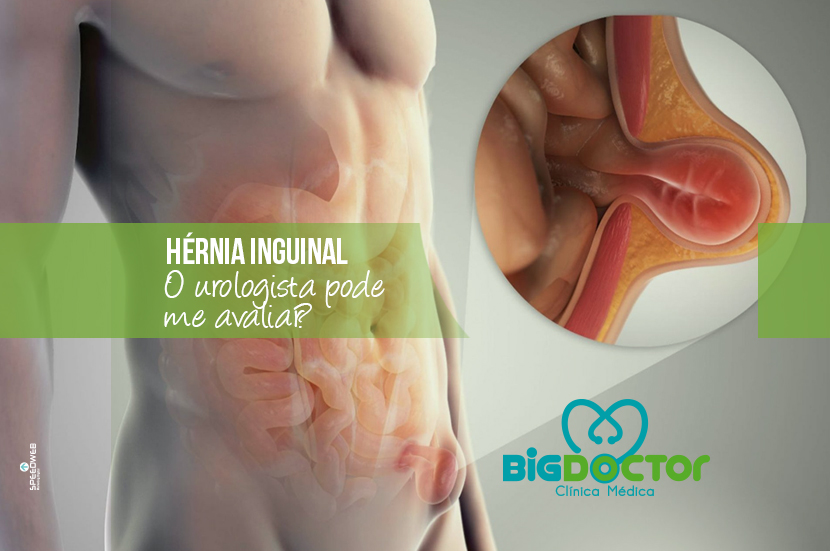 Hérnia Inguinal – O Urologista pode me avaliar?