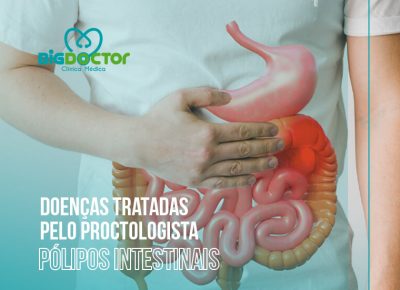 Doenças tratadas pelo Proctologista: Pólipos intestinais