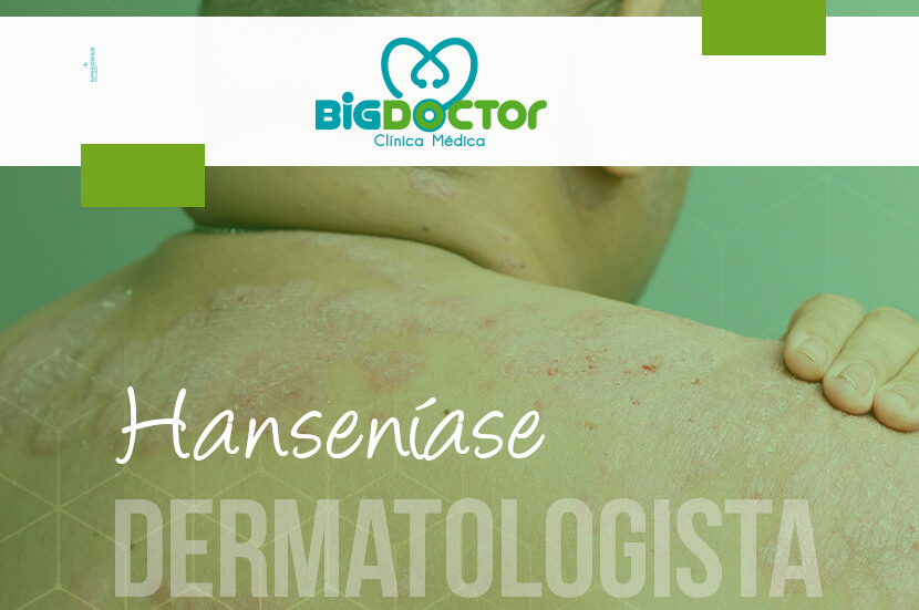 Hanseníase – Clínica Big Doctor