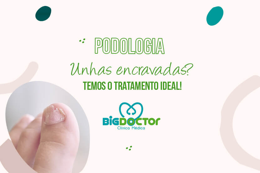 Unhas encravadas? Temos o tratamento ideal!