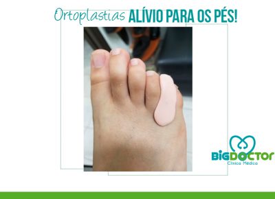 Ortoplastias: Alívio para os pés!