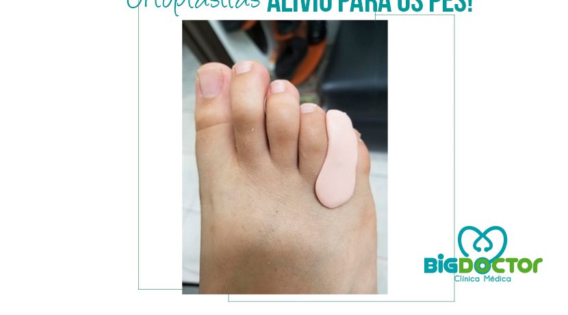 Ortoplastias: Alívio para os pés!