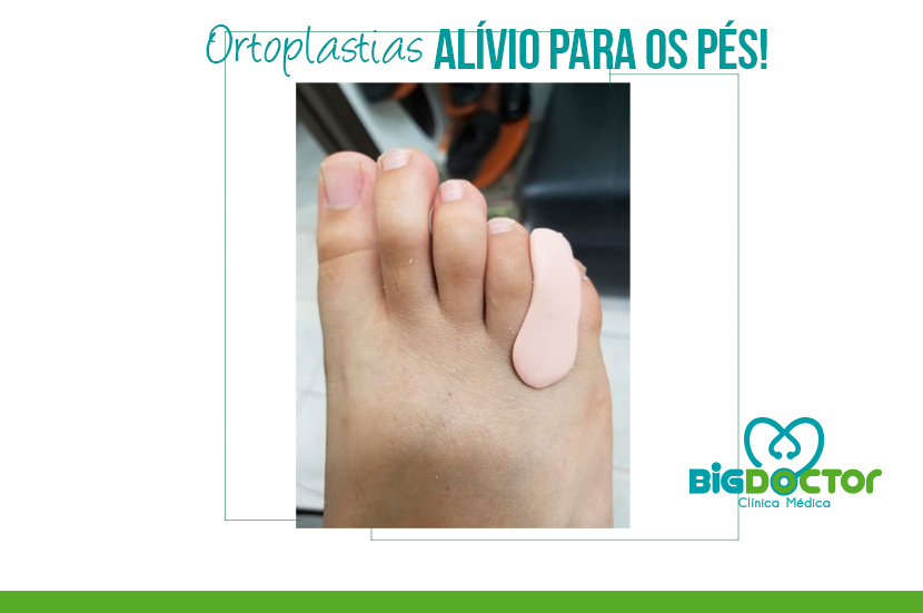 Ortoplastias: Alívio para os pés!